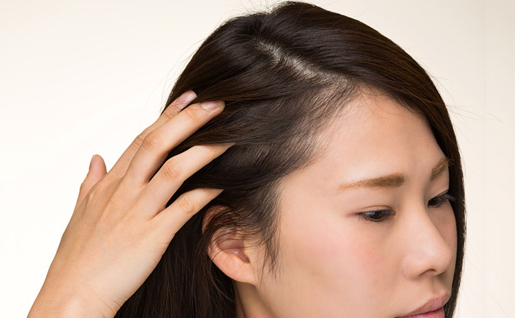 40代女性の頭皮の臭いは加齢臭が原因だった。専門家が詳しく解説